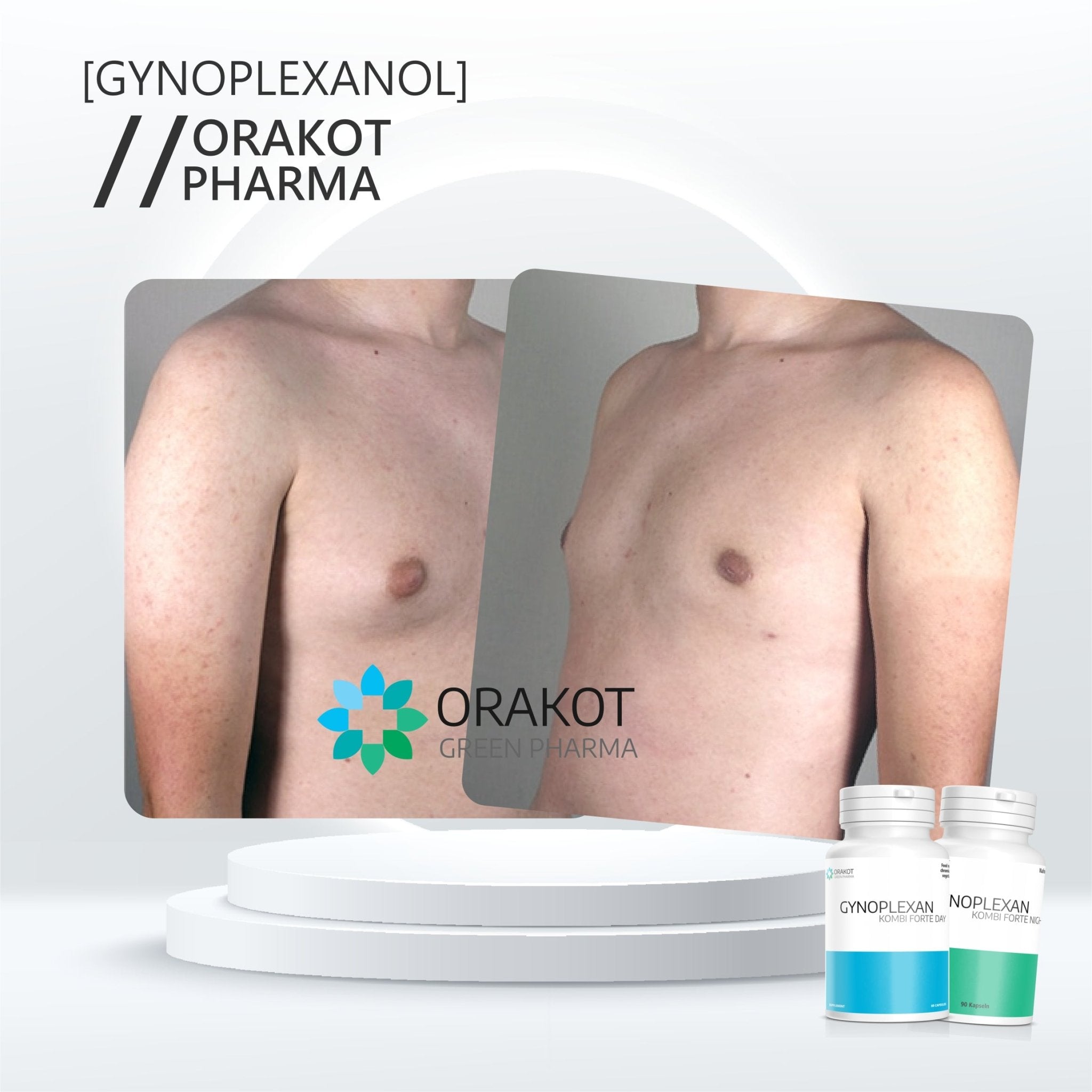 Gynoplexanol Forte DUO gegen Gynäkomastie - Orakot Pharma