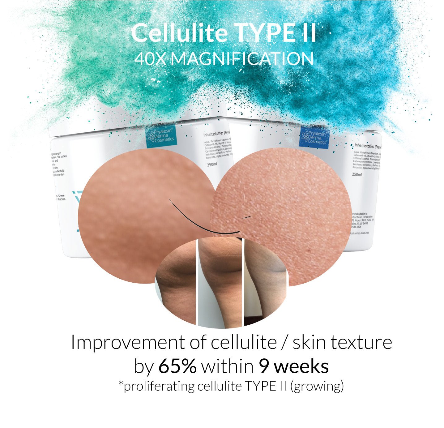 Platz 1 - Anti Cellulite Creme Test: MyNaturalSecret - Pryalesin PROCELL Duo 2 - Anti Cellulite